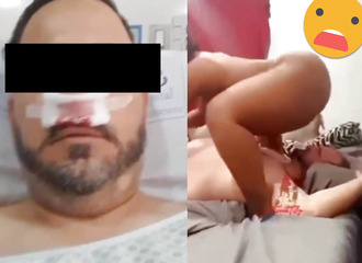 Découvrez comment il s'est cassé le nez !