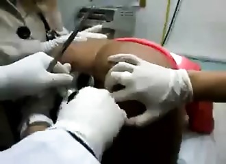 Spéculum et insertion hard par ce gynéco